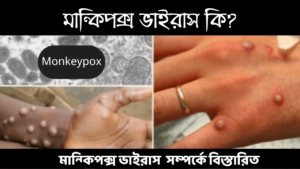 Read more about the article মান্কিপক্স ভাইরাস কি? মান্কিপক্স এখন বাংলাদেশেও | Monkeypox Virus in Bangladesh